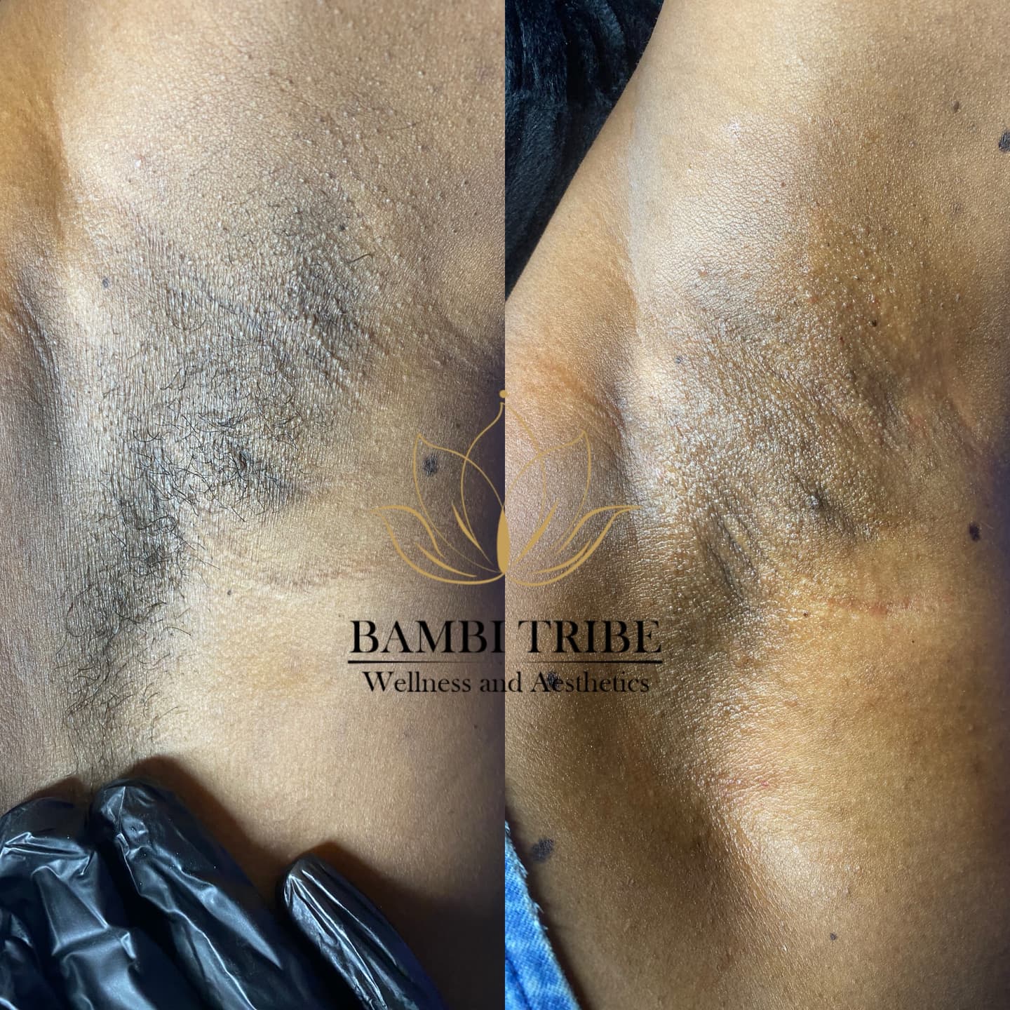 Work by Bambi Tribe Wellness & Aesthetics